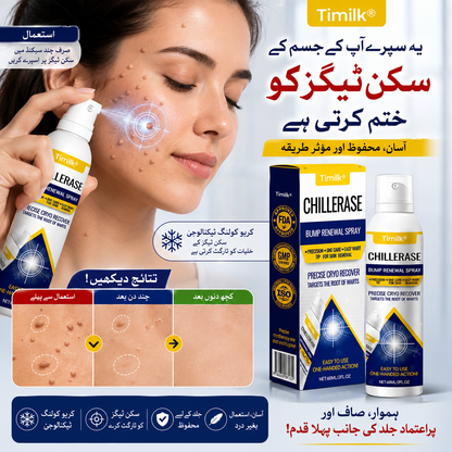 Timilk® Chillerase Bump Renewal Spray Skin Spray.