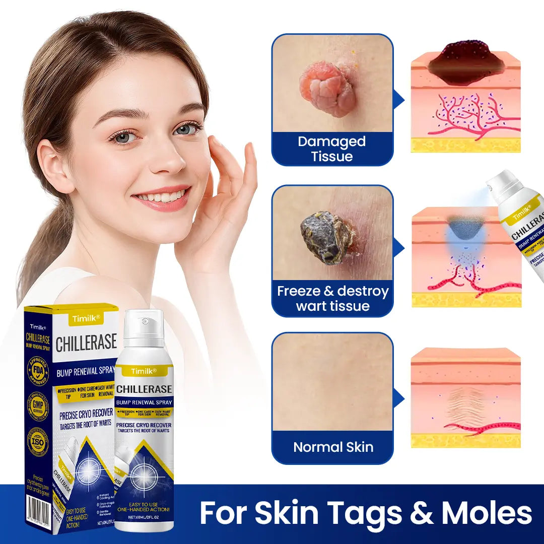 Timilk® Chillerase Bump Renewal Spray Skin Spray.