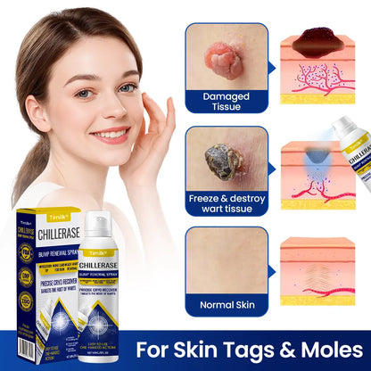 Timilk® Chillerase Bump Renewal Spray Skin Spray.