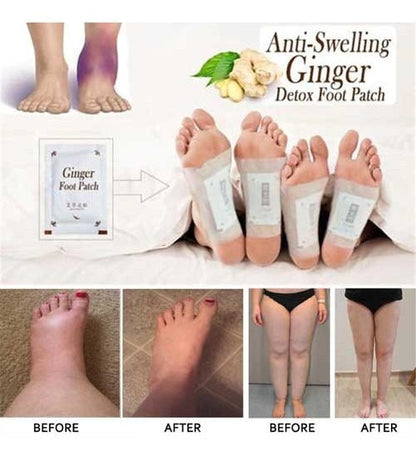 Kinoki Cleansing Toxins Remover Detox Foot Pads for Men and Women  ( 10 pads )